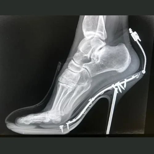 Feet hurt from wearing heels on sale